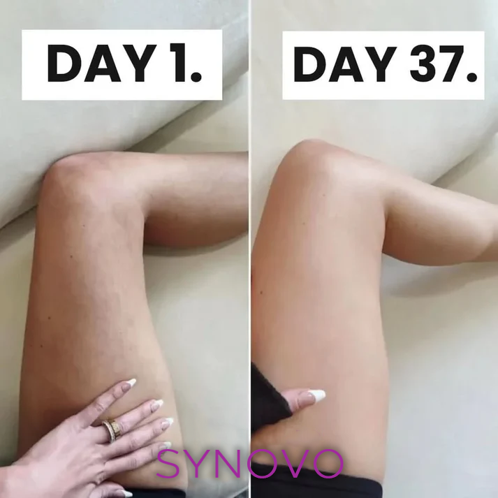 Flolegs by Synovo -   The celebs Anti-cellulite tights