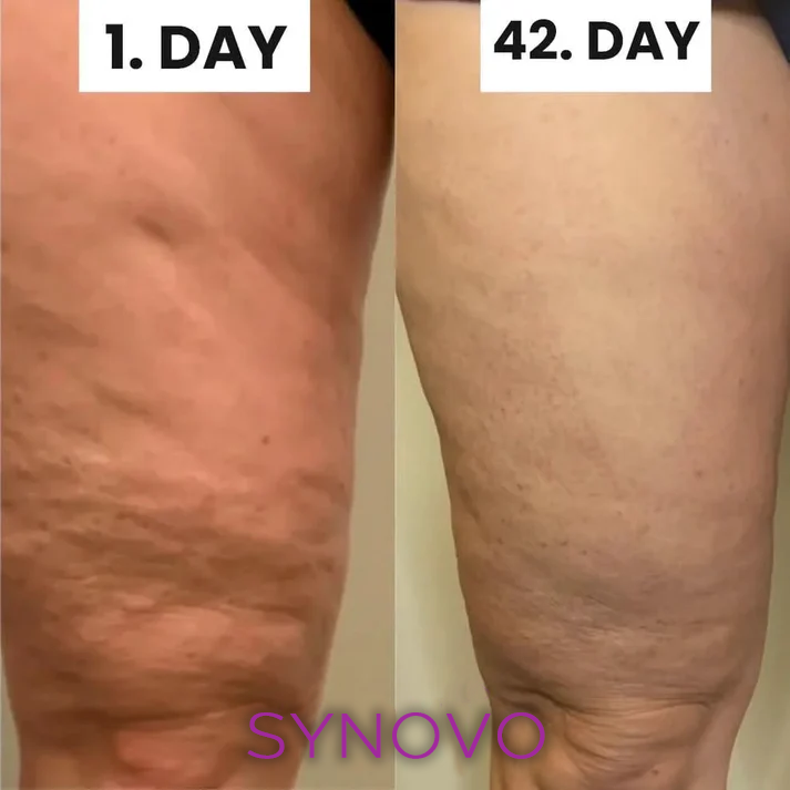 Flolegs by Synovo -   The celebs Anti-cellulite tights